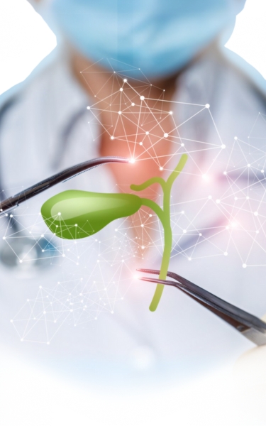 Gastric Bypass Surgery