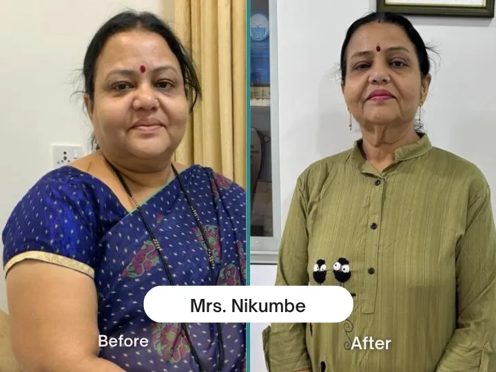 Mrs Nikumbe