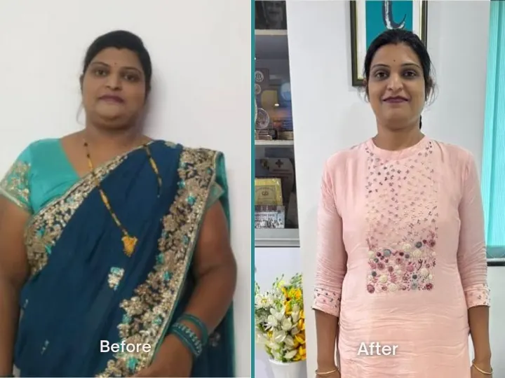 Weight Loss Transformation