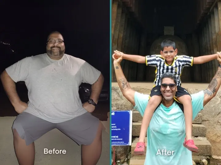 Weight Loss Patient 1