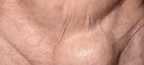 Ageing